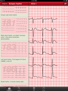 the ecg collection ipad app