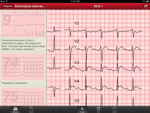 the ecg collection ipad app