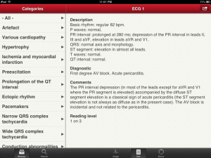 the ecg collection ipad app