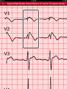 the ecg collection ipad app