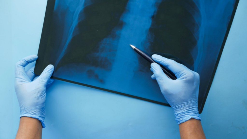 What Is Digital Radiography and How Does It Work?