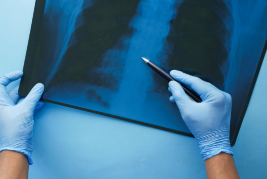 What Is Digital Radiography and How Does It Work?
